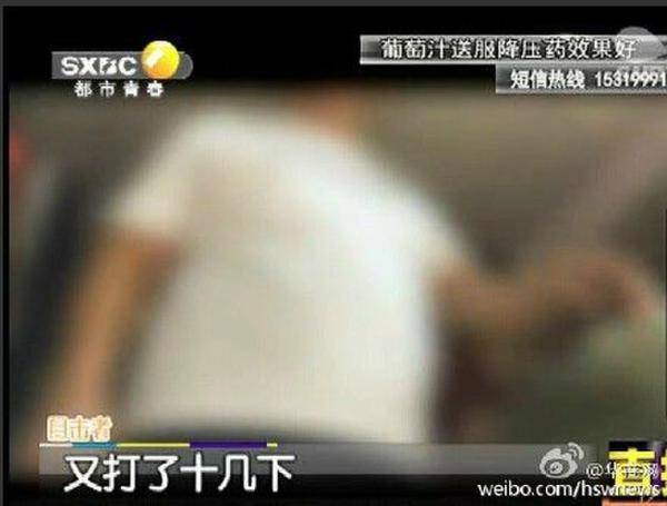 西安六旬老人闹市遭三男子暴打 四肢被打断(3)